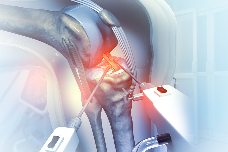 A Comprehensive Overview of Joint Replacement Surgery